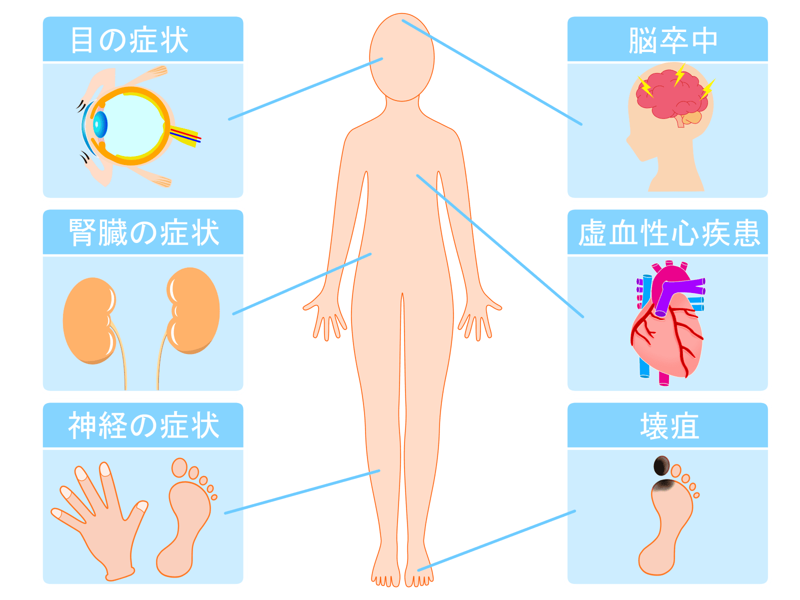 糖尿病の合併症