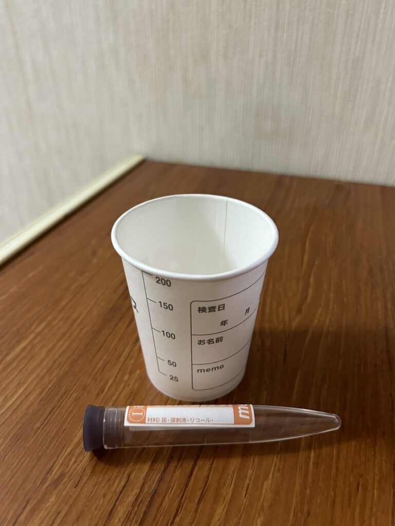 尿検査って何を見ているの？